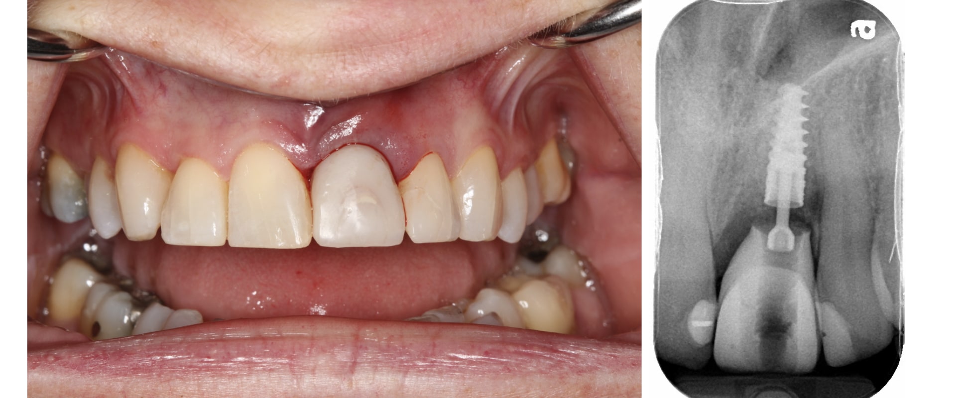 What Does a Prosthodontist Do? A Comprehensive Guide