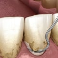 Can prosthodontist treat periodontitis?