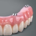 What is covered by prosthodontics?