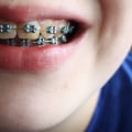 What is the difference between an orthodontist and a prosthodontist?