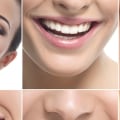Do prosthodontists clean teeth?