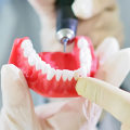 Do prosthodontists extract teeth?
