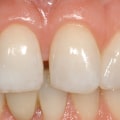 How Much Do Prosthodontists Earn in the UK?