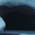 What Does a Prosthodontist Focus On?